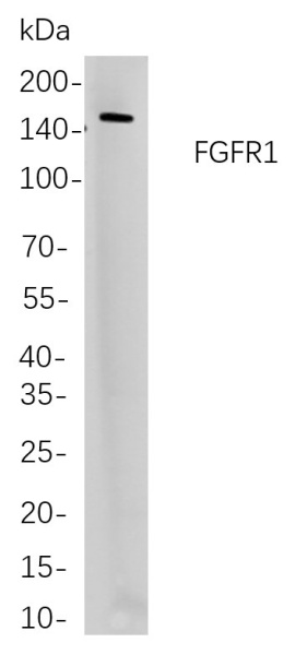 Recombinant FGFR1 Monoclonal Antibody (AN301100L)
