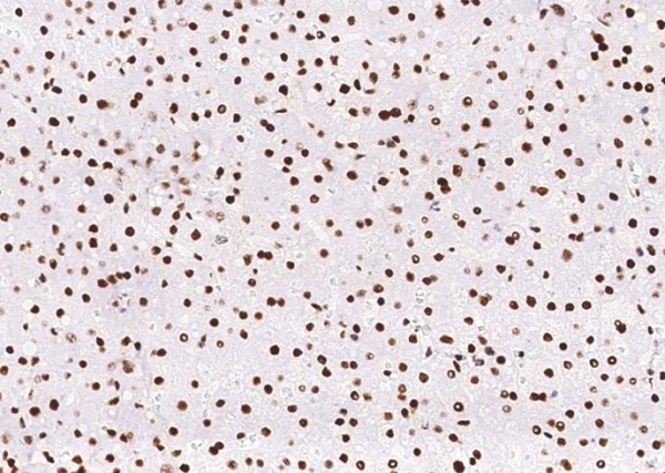 Recombinant PCNA Monoclonal Antibody (AN300418P)