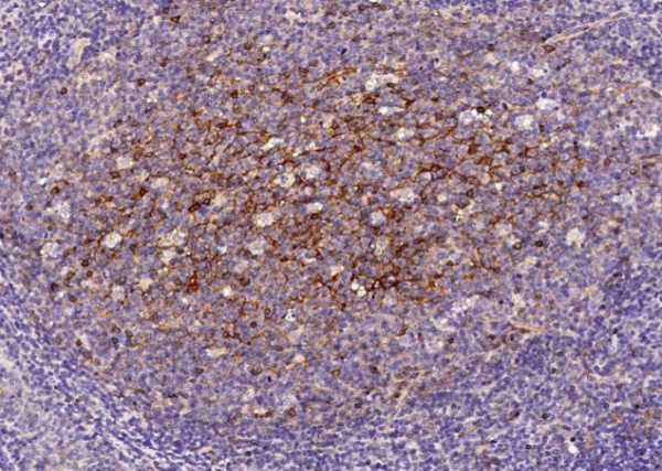 Recombinant CD200 Monoclonal Antibody (AN300209P)