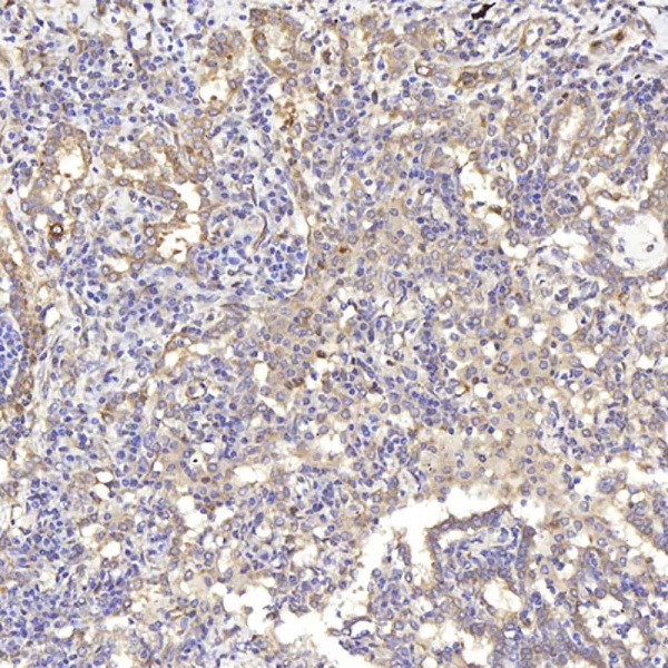 IKK alpha Polyclonal Antibody (E-AB-70151)