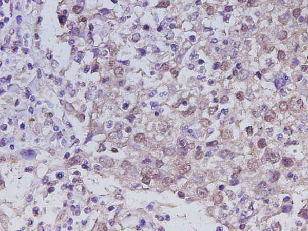 RUNX2 Polyclonal Antibody (D-AB-10450L)
