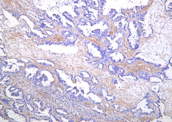Recombinant SREBP-1 Monoclonal Antibody (AN301398L)