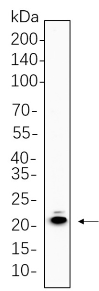 Recombinant MYL9 Monoclonal Antibody (AN300700L)