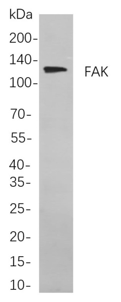 Recombinant FAK Monoclonal Antibody (AN301036L)