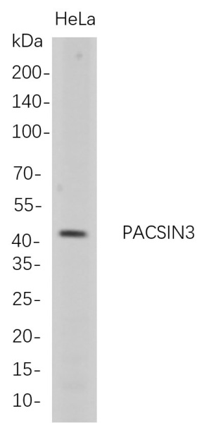 Recombinant PACSIN3 Monoclonal Antibody (AN300767L)
