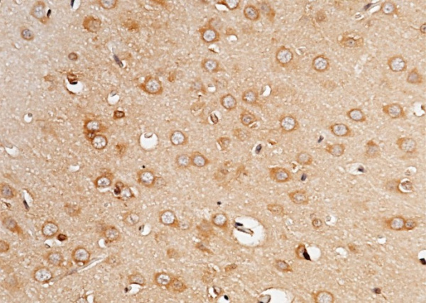 PCSK9 Monoclonal Antibody (AN200249P)