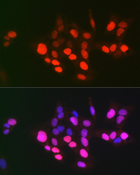 DNA topoisomerase II alpha Polyclonal Antibody (E-AB-90025)