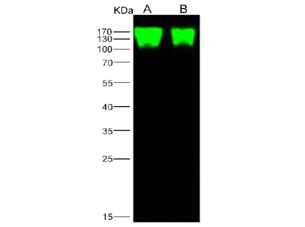 Anti-Epstein-Barr virus(Herpesvirus 4) EBV Glycoprotein gp350/EBV GP350 Polyclonal Antibody (E-AB-V1091)