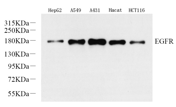 EGFR Polyclonal Antibody (E-AB-70303)