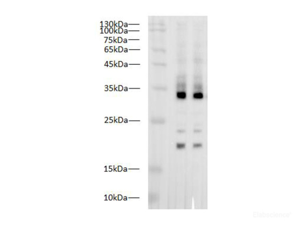 IL1 beta Polyclonal Antibody (E-AB-40530)