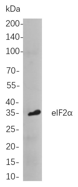 Recombinant eIF2α Monoclonal Antibody (AN300883L)