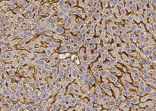 Recombinant Vitronectin/VTN Monoclonal Antibody (AN300537P)