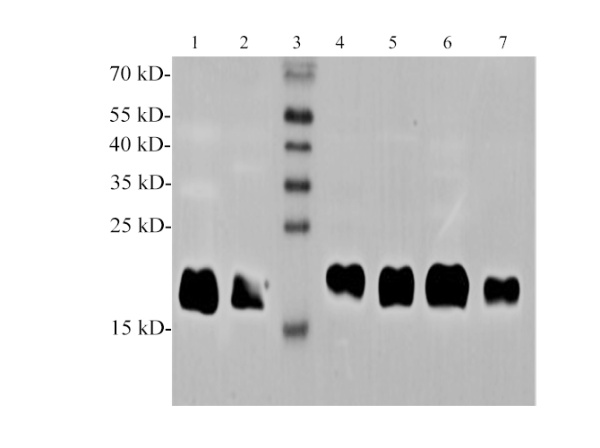 Ferritin Polyclonal Antibody (E-AB-40577)