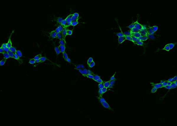 Recombinant NCAM Monoclonal Antibody (AN300345P)