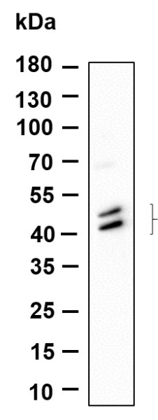 Recombinant Phospho-Jun, JunD (Ser73, Ser100) Monoclonal Antibody (AN301147L)