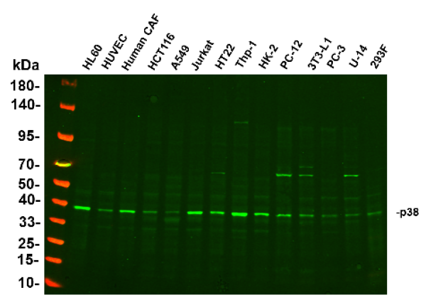 Recombinant p38 Monoclonal Antibody (AN300925L)