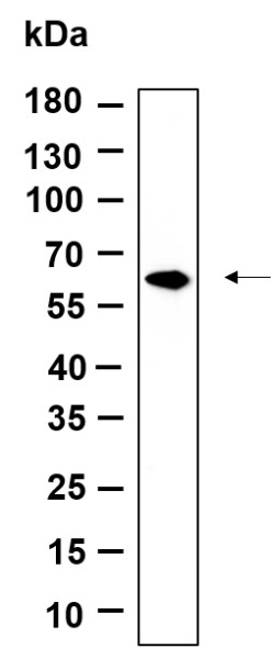 Recombinant FPGS Monoclonal Antibody (AN301242L)