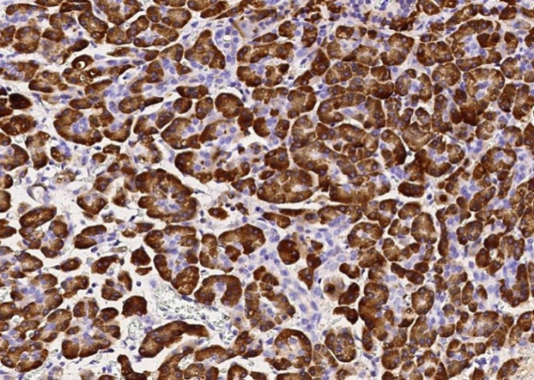 Carboxypeptidase B1/CPB1 Monoclonal Antibody (AN200105P)