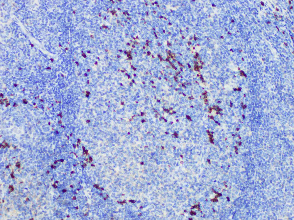 IgG Monoclonal Antibody (ELAB6831-R)