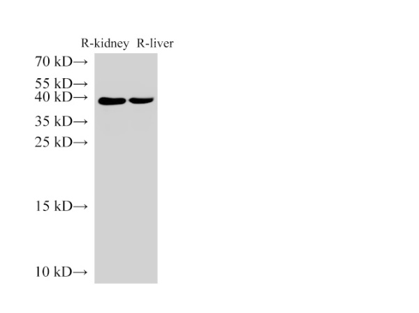 AMACR Polyclonal Antibody (D-AB-10240L)