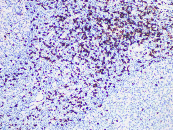 CD8 Monoclonal Antibody (ELAB6717-M)
