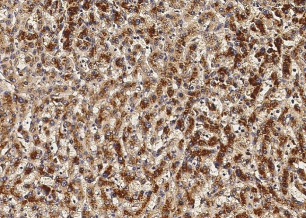 VEGF/VEGFA Monoclonal Antibody (AN200010P)