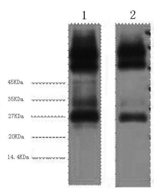 EFHD1 Monoclonal Antibody (E-AB-22043)