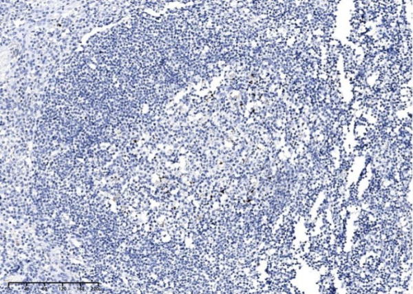 PARP-1 Monoclonal Antibody (AN200039P)