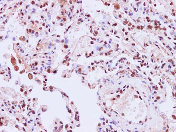 STIL Polyclonal Antibody (E-AB-40237)