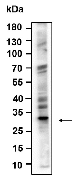Recombinant ALKBH2 Monoclonal Antibody (AN301228L)