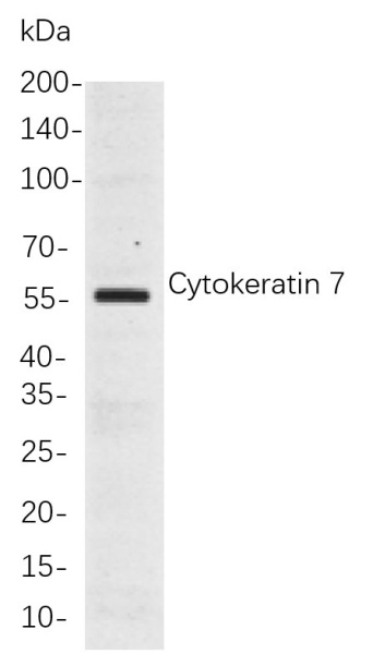 Recombinant Cytokeratin 7 Monoclonal Antibody (AN300948L)