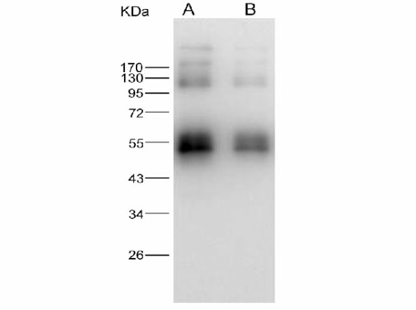 Anti-Zika virus(ZIKV)(strain Zika SPH2015) ZIKV-NS1 Monoclonal Antibody (E-AB-V1338)