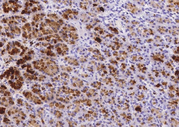 REG1A Monoclonal Antibody (AN200211P)