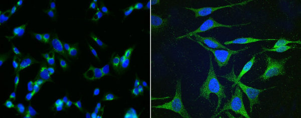 Apolipoprotein H/APOH Monoclonal Antibody (AN200209P)