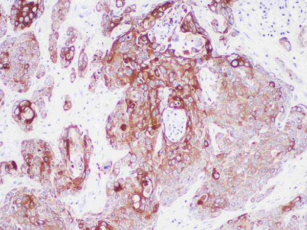 CK6 Monoclonal Antibody (ELAB6730-M)