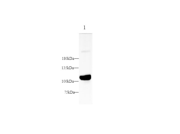 PSMA Polyclonal Antibody (D-AB-10276L)