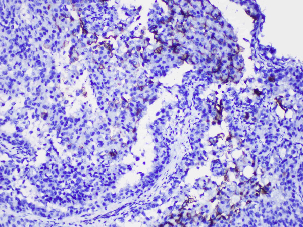Uroplakin III Monoclonal Antibody (ELAB6138-M)