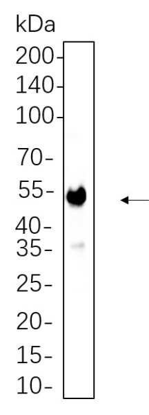 Recombinant CaMKII α Monoclonal Antibody (AN300837L)
