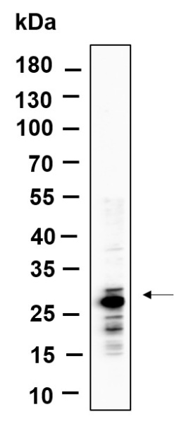 Recombinant MTCO2 Monoclonal Antibody (AN301103L)