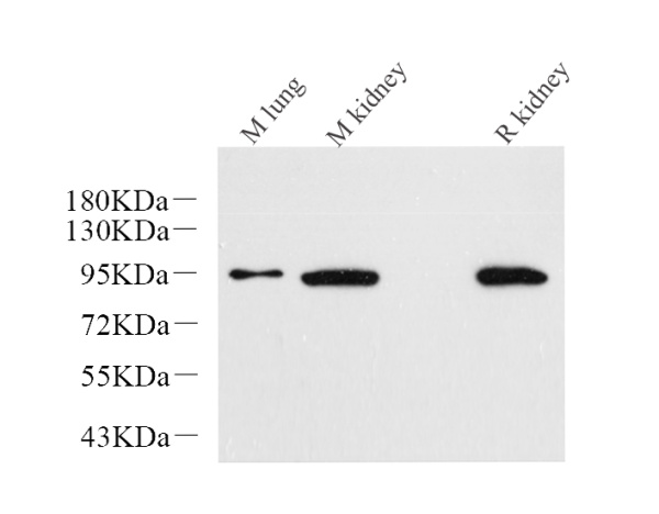 Catenin beta Monoclonal Antibody (E-AB-70230)