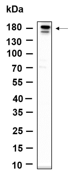 Recombinant Phospho-ErbB-3 (Tyr1289) Monoclonal Antibody (AN301394L)