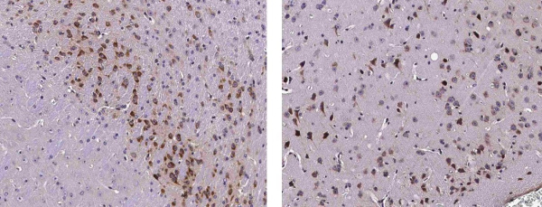 Recombinant Neuroserpin/SerpinI1 Monoclonal Antibody (AN300567P)