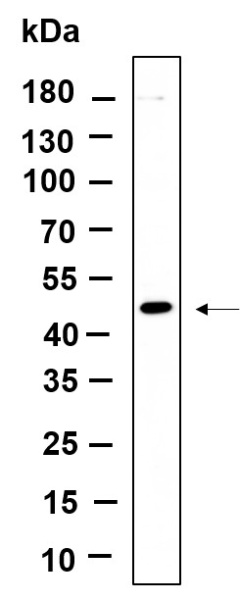 Recombinant DPS1 Monoclonal Antibody (AN301221L)