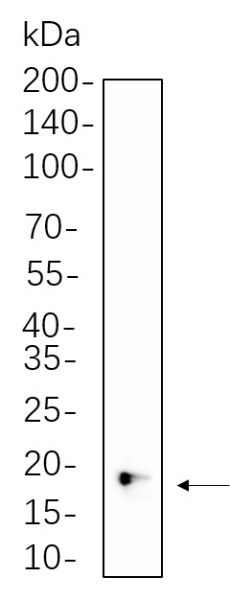 Recombinant 4E-BP1 Monoclonal Antibody (AN300817L)