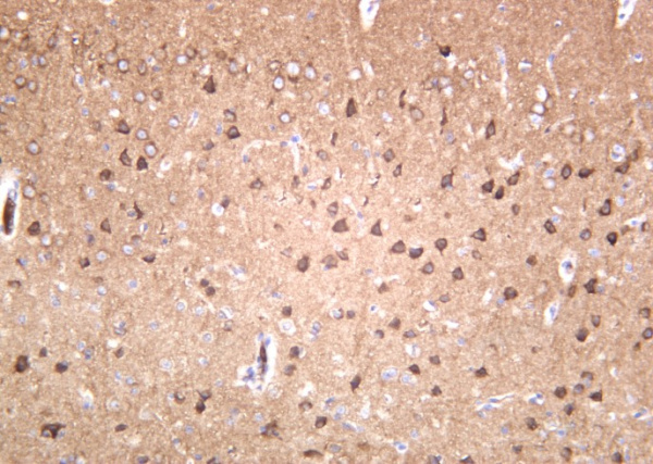 Recombinant GluR-2 Monoclonal Antibody (AN301279L)