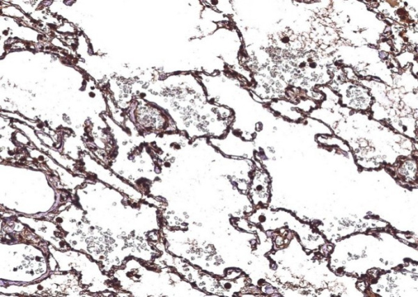 Recombinant CHI3L2/YKL-39 Monoclonal Antibody (AN300249P)