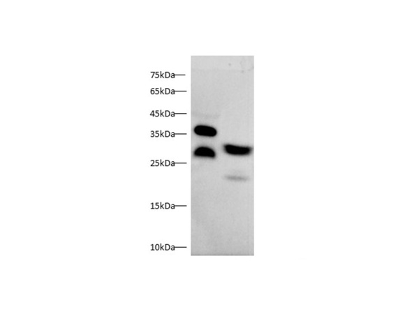 MBL2/MBP-C Polyclonal Antibody (D-AB-10438L)