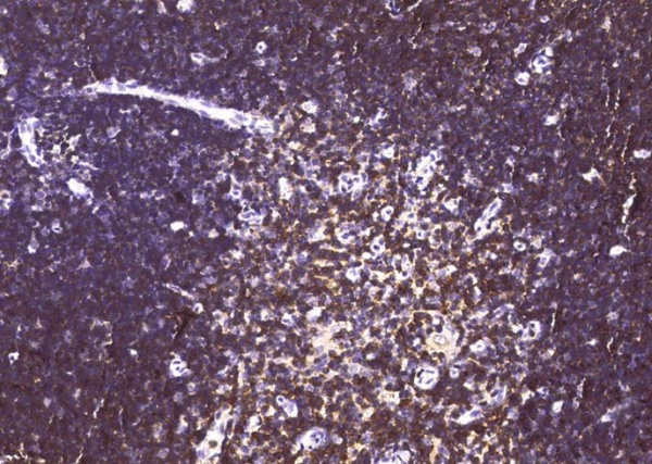 CD6/Cluster of Differentiation 6 Monoclonal Antibody (AN200253P)