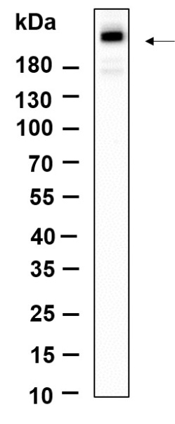 Recombinant Phospho-mTOR (Ser2481) Monoclonal Antibody (AN301135L)