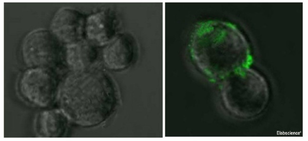 SARS-COV-2 Spike Monoclonal Antibody(2019-nCoV) (E-AB-V1003)